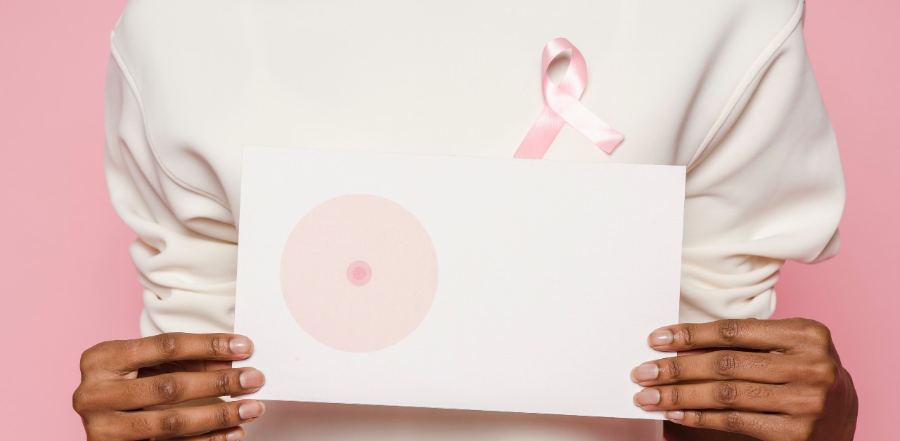 Prevención de cáncer de mama